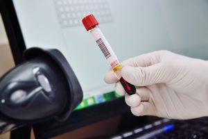 Abbildung medizinischer Barcode wird gescannt